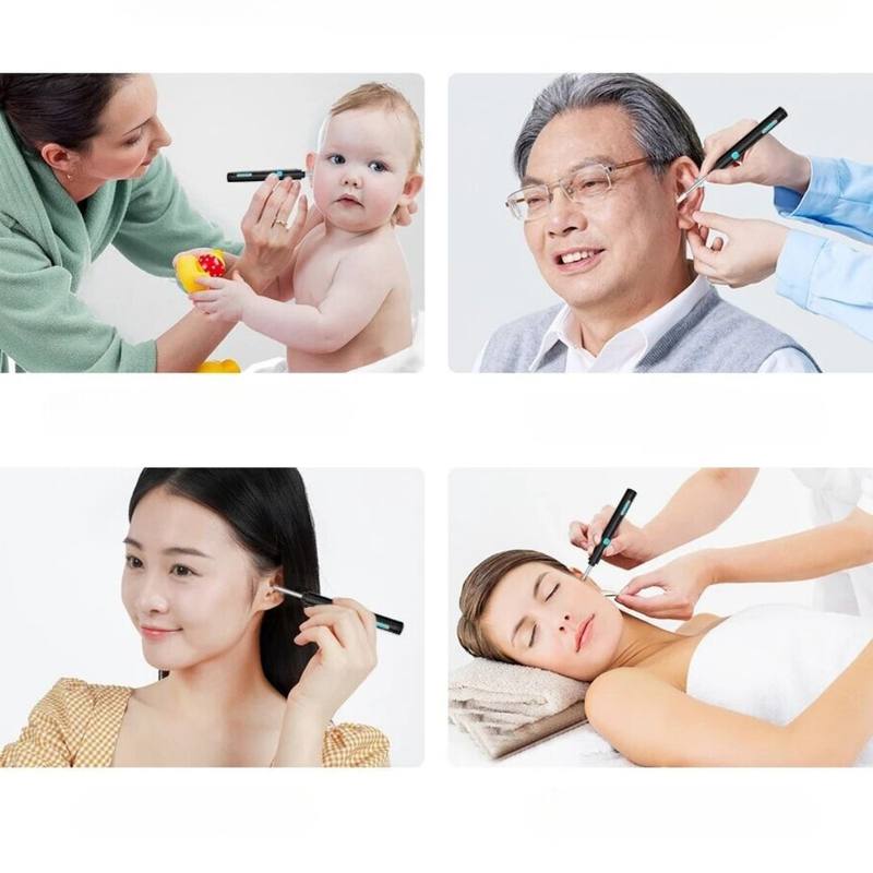 Visual Ear Scoop