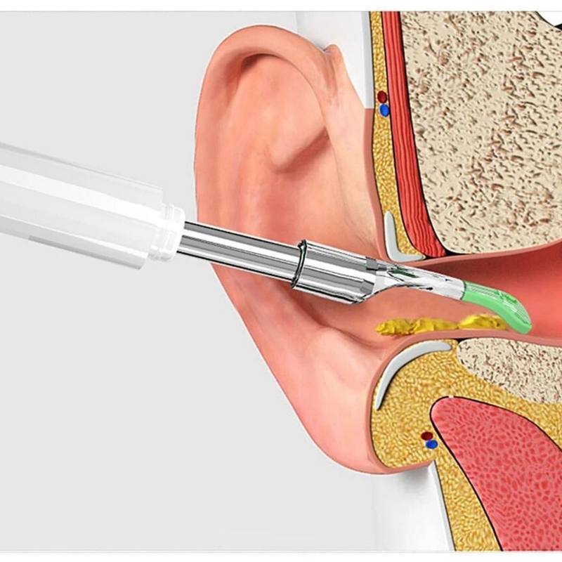 Visual Ear Scoop