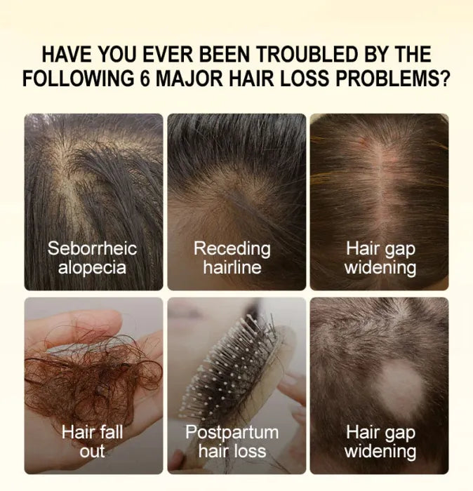 Hair Treatment For Anti Hair Loss & Hair Growth
