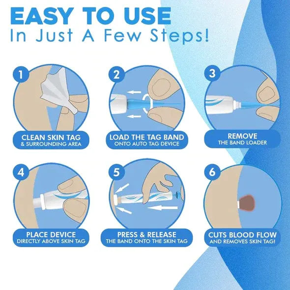 Mole Removal