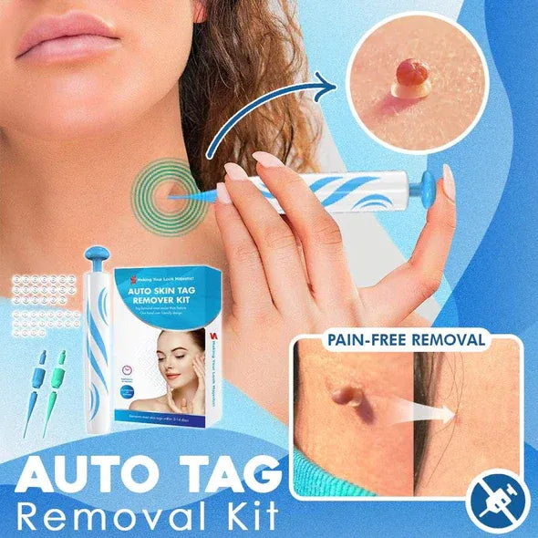 Mole Removal
