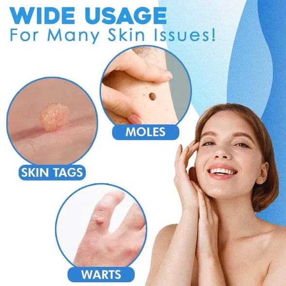 Mole Removal
