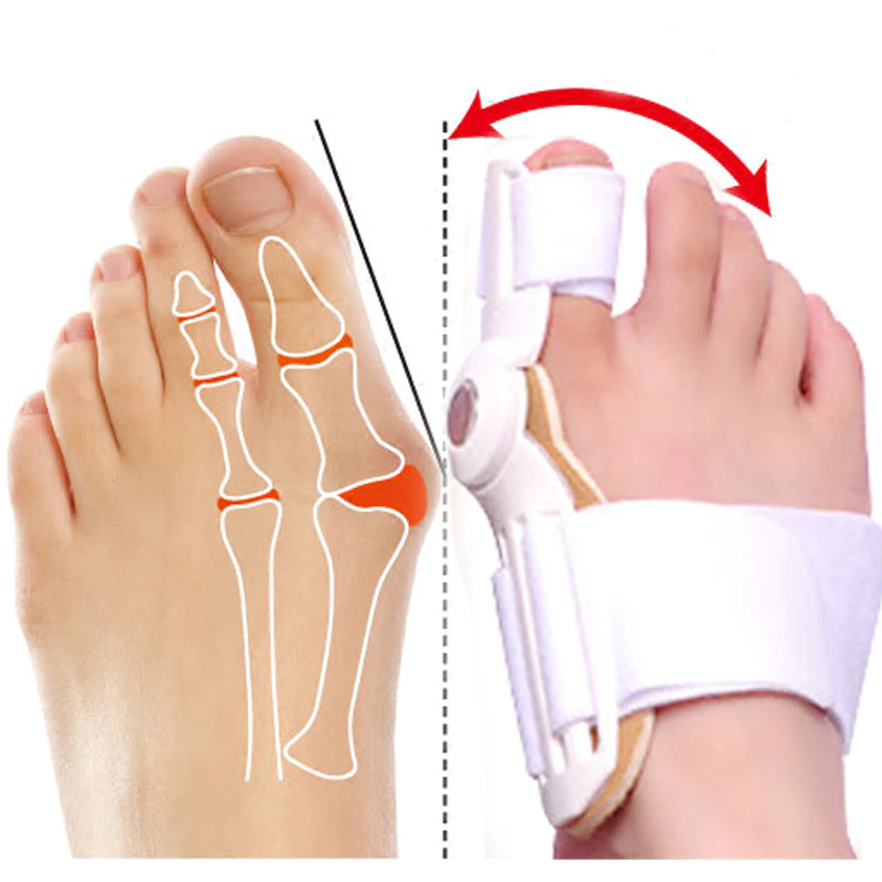 Seaqers™ Adjustable Toe Straightener